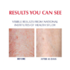 Fragrance Free Body Lotion for Dry Skin - Image 3